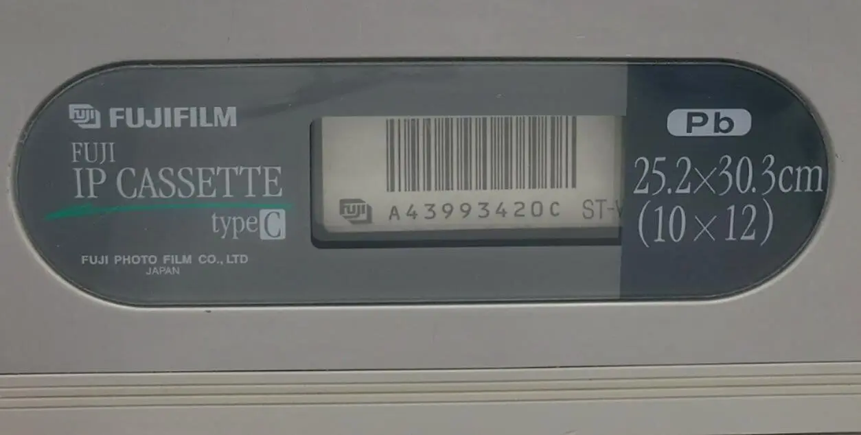 Fujifilm 10 x 12 IP Cassette Type C with Imaging Plate PB - Image 5