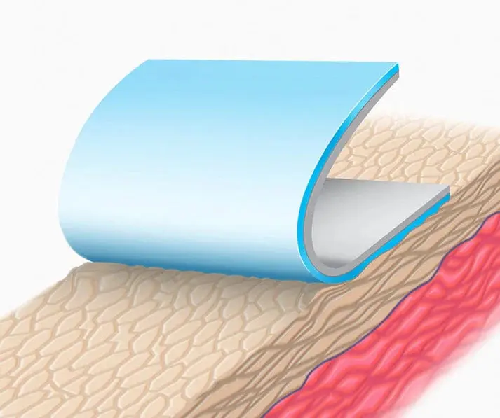 Advancis Silflex Soft Silicone Wound Contact Layer Non-Adherent Mesh 10 Box - Image 4