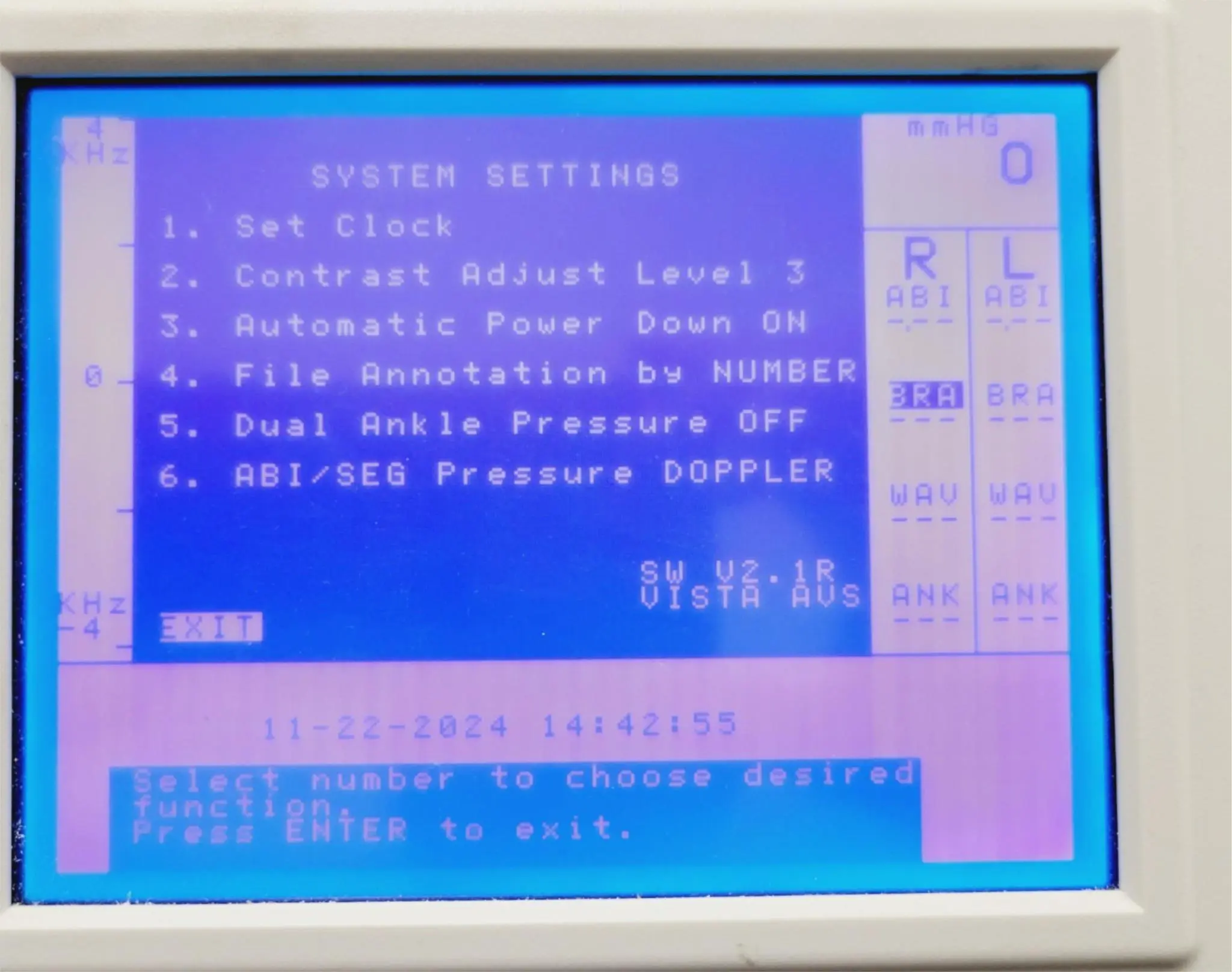 Summit Doppler Vista Avs Vascular System SW Version V2.1R Bio-Med Certified - Image 4