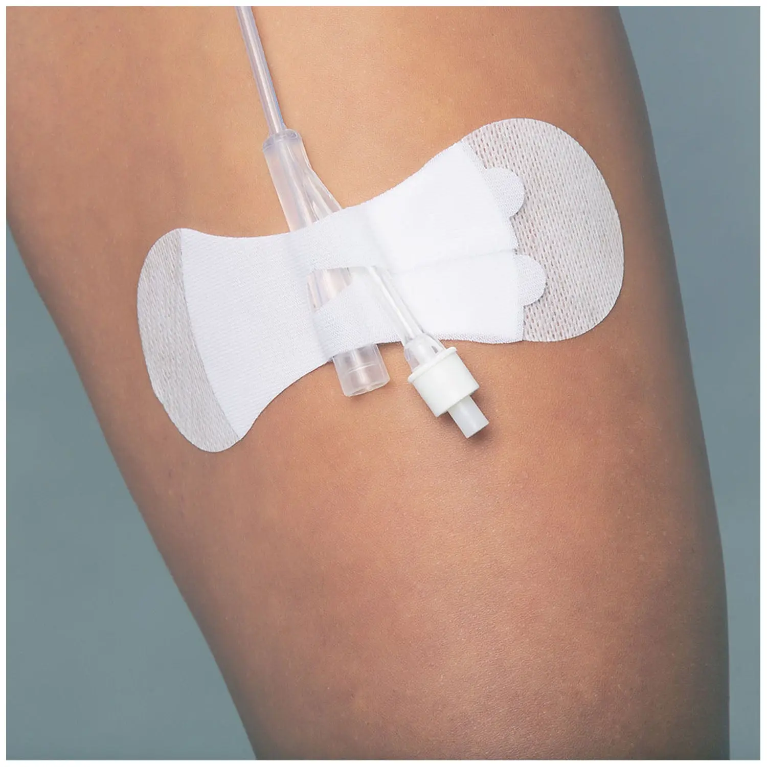 TIDI 3400LFC GRIP-LOK FOLEY SECUREMENT DEVICE - Universal Foley Large, Sterile, 100/bx